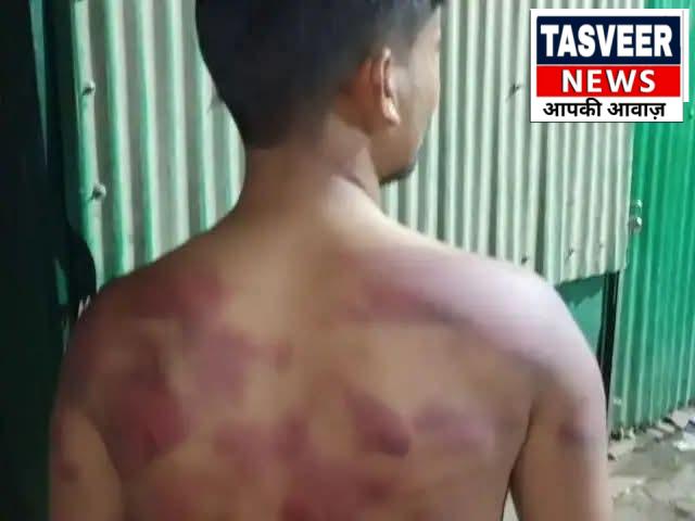 प्रेमिका से मिलने पहुंचा युवक बना दरिंदगी का शिकार, नपुंसक बनाने तक की कोशिश