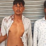 सहसवान: रंजिश की आग में खूनी खेल, भंडारे से लौट रहे युवक और उसके साथी पर जानलेवा हमला