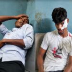 कमालगंज में कांवड़ियों की बाइकों में जोरदार भिड़ंत, दो श्रद्धालु घायल,जल भरकर लौटते समय हुआ हादसा, सीएचसी से दोनों को लोहिया अस्पताल किया गया रेफर