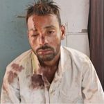 पशुओं को पानी पिलाना पड़ा भारी! पुरानी रंजिश में ग्रामीण पर लाठी-डंडों से हमला, लहूलुहान कर दी दबंगई; जान से मारने की धमकी देकर फरार